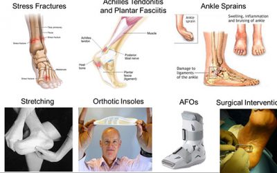 JI mini-workshop series: “systematic approach for foot and ankle injuries”